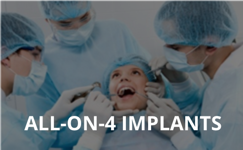 All on 4 Implants Link